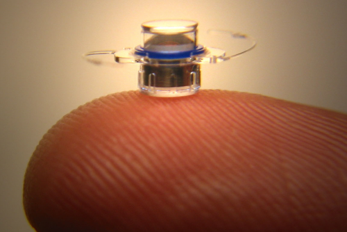 télescope miniature implantable (IMT) de la société VisionCare
