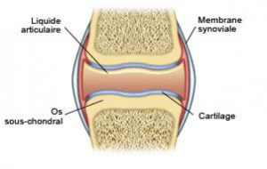 Arthrose