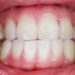 Dents - Dentiste - Santé bucco-dentaire personnes âgées