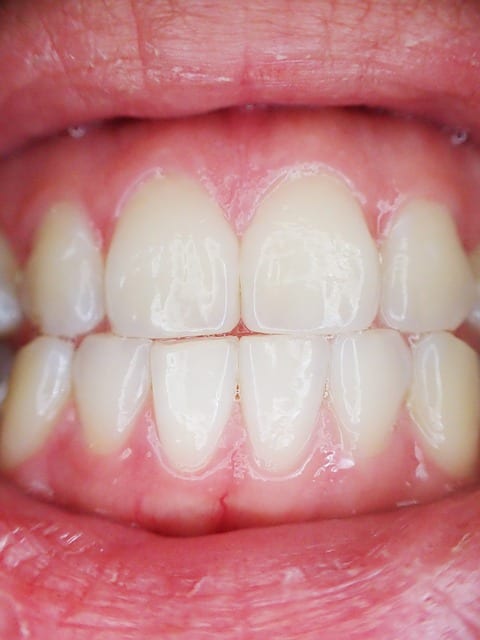 Dents - Dentiste - Santé bucco-dentaire personnes âgées