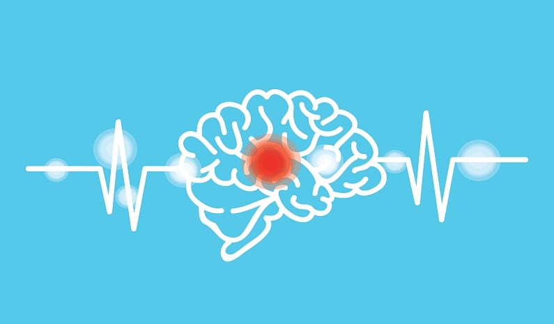 AVC Accident vasculaire cérébral prévention