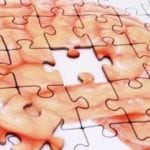 Alzheimer-santé-cerveau-Une
