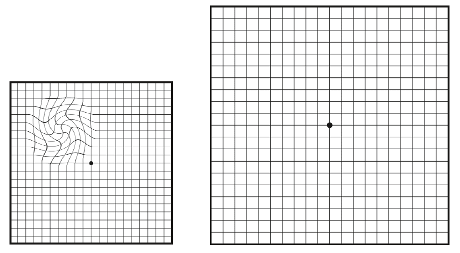 Grille d'amsler - vision - malvoyance - dmla