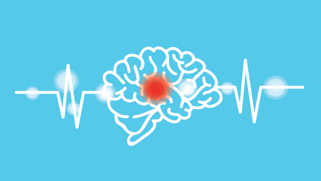ondes cerveau parkinson